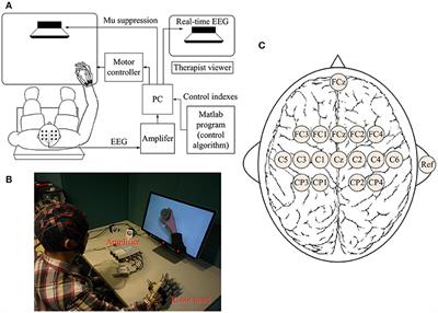 Changes in Electroencephalography Complexity using a Brain Computer Interface-Motor Observation Training in Chronic Stroke Patients: A Fuzzy Approximate Entropy Analysis